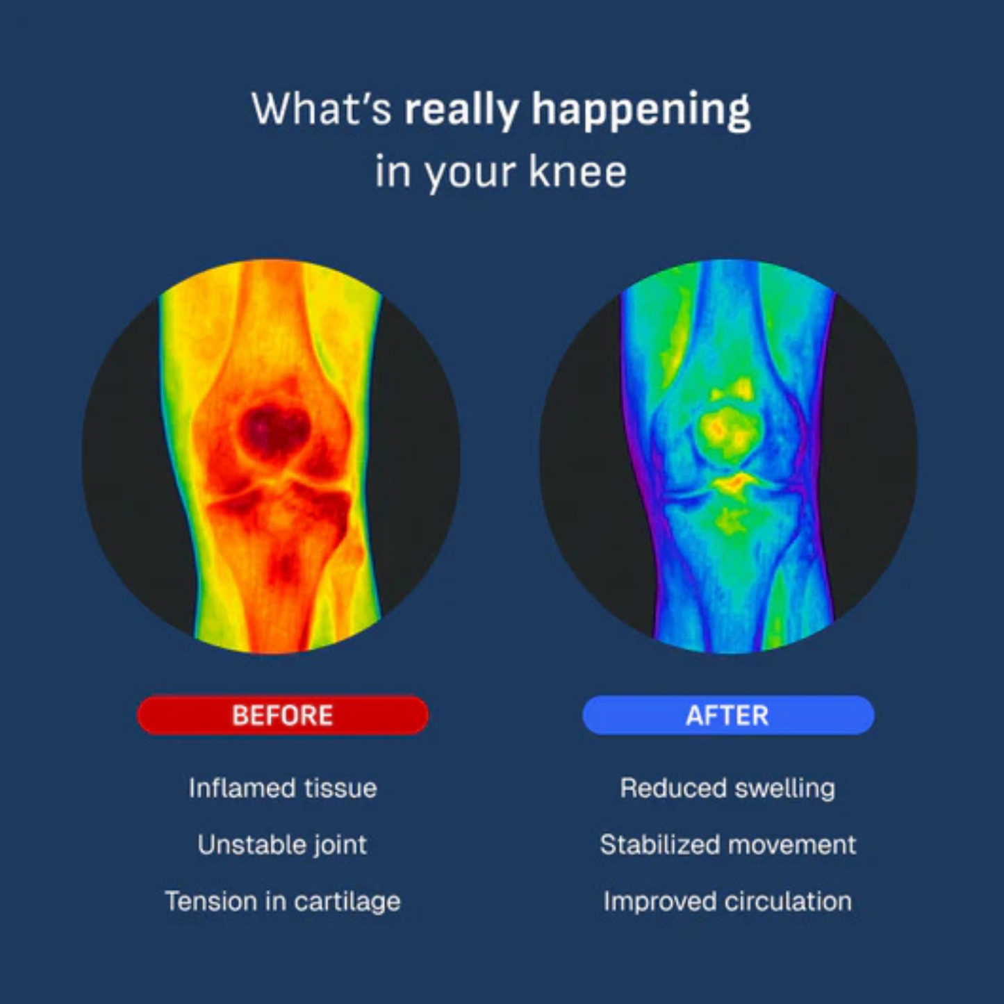 Glwria™ - Intelligente Kniebandage