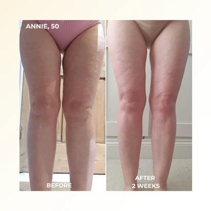 4-in-1 Fascia Full-Body Sculpting Blade