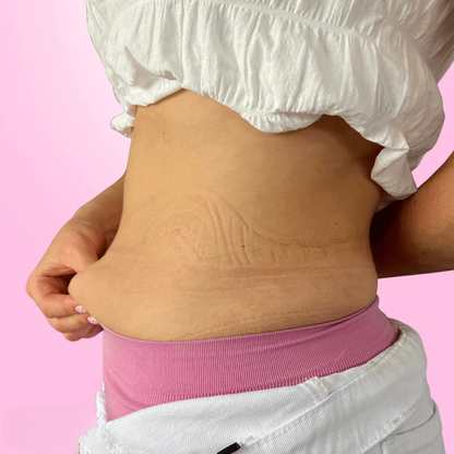 GLWRIA Body Lifting Tape: Instant Tummy & Arm Lift